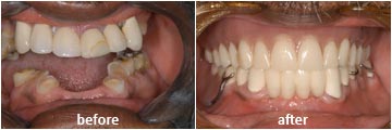 case4