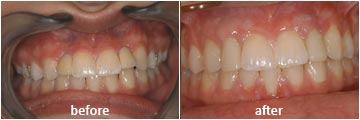 case5