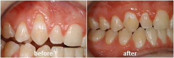 case6