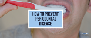 How To Prevent Periodontal Disease