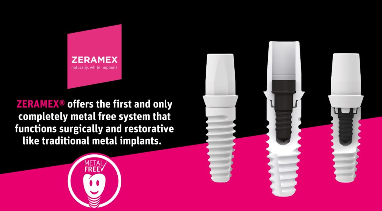 Zirconia Dental Implants Memphis TN Periodontal Associates of Memphis