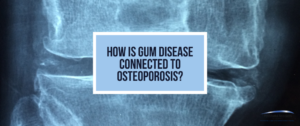Osteoporosis