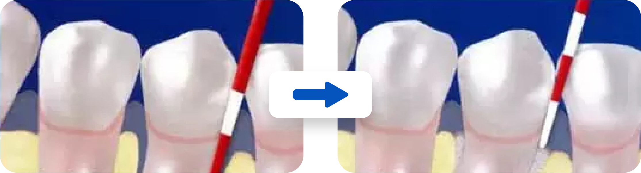 110-111-110
