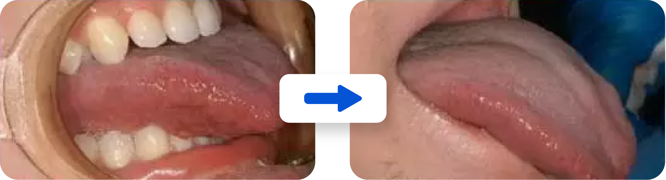 70