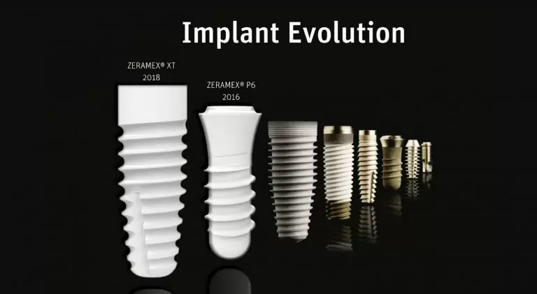 implant-dentistry-evolution-1-768x421