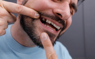 Understanding Gum Grafts: Restoring Your Smile and Protecting Your Teeth