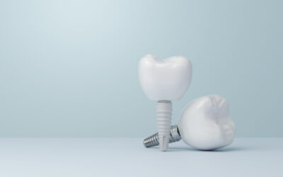 Zirconia vs. Titanium Implant Abutments: A Guide for Memphis Patients