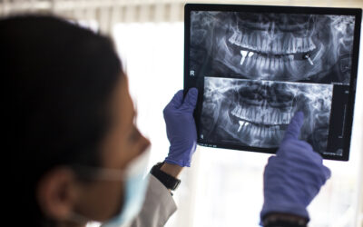 Understanding Implant Dentistry: How an Implant Dentist Can Restore Your Smile