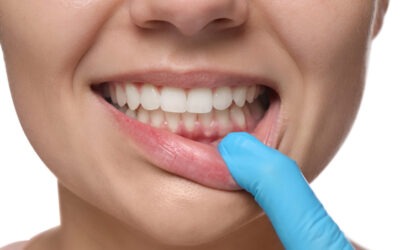 Effective Bleeding Gums Treatment: Regain Healthy Gums Today