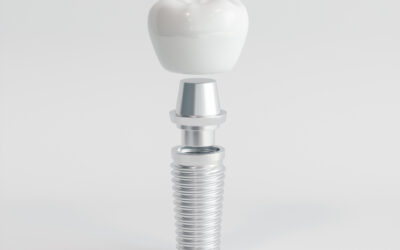 How Long Do Dental Implants Really Last? Lifespan, Risks, and Care
