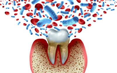 8 Silent Signs of Gum Disease Adults Should Never Ignore